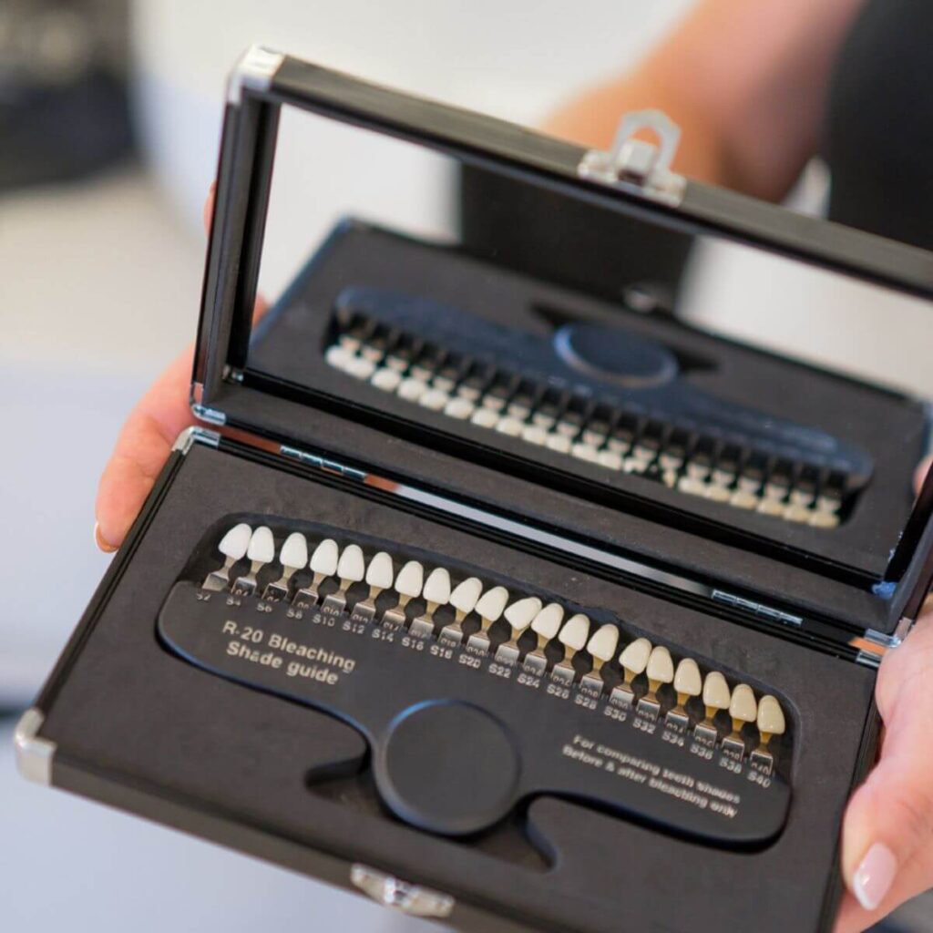 16_kosmetyczne_wybielane_zebow_ustron_wisla_istebna