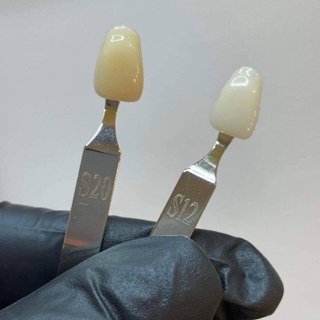 18_kosmetyczne_wybielane_zebow_ustron_wisla