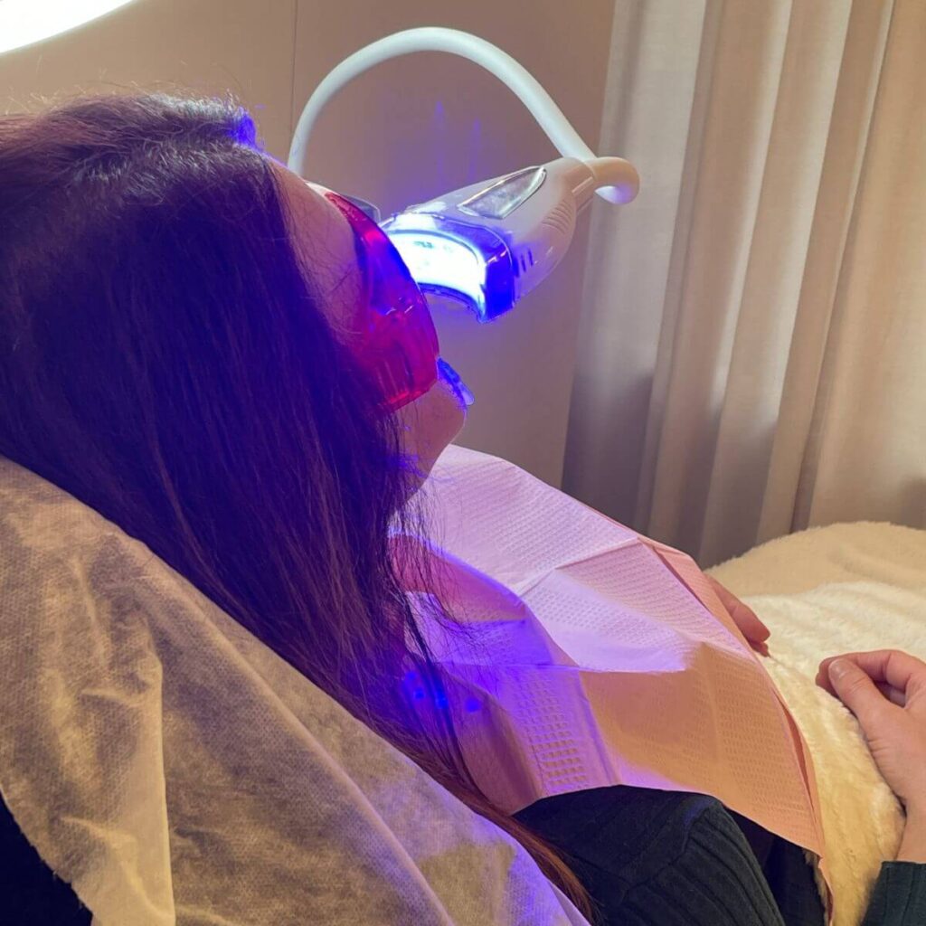 22_ustron_kosmetyczne_wybielane_zebow