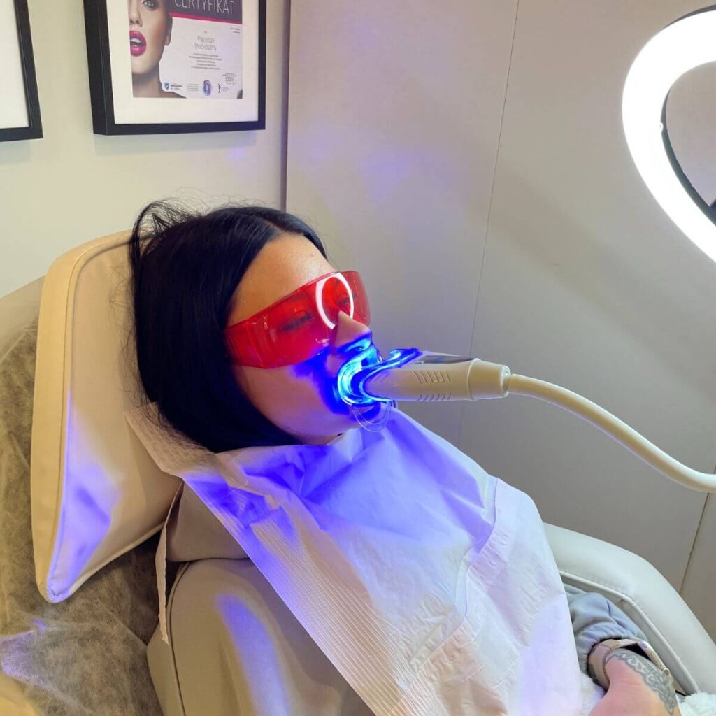 23_ustron_kosmetyczne_wybielane_zebow