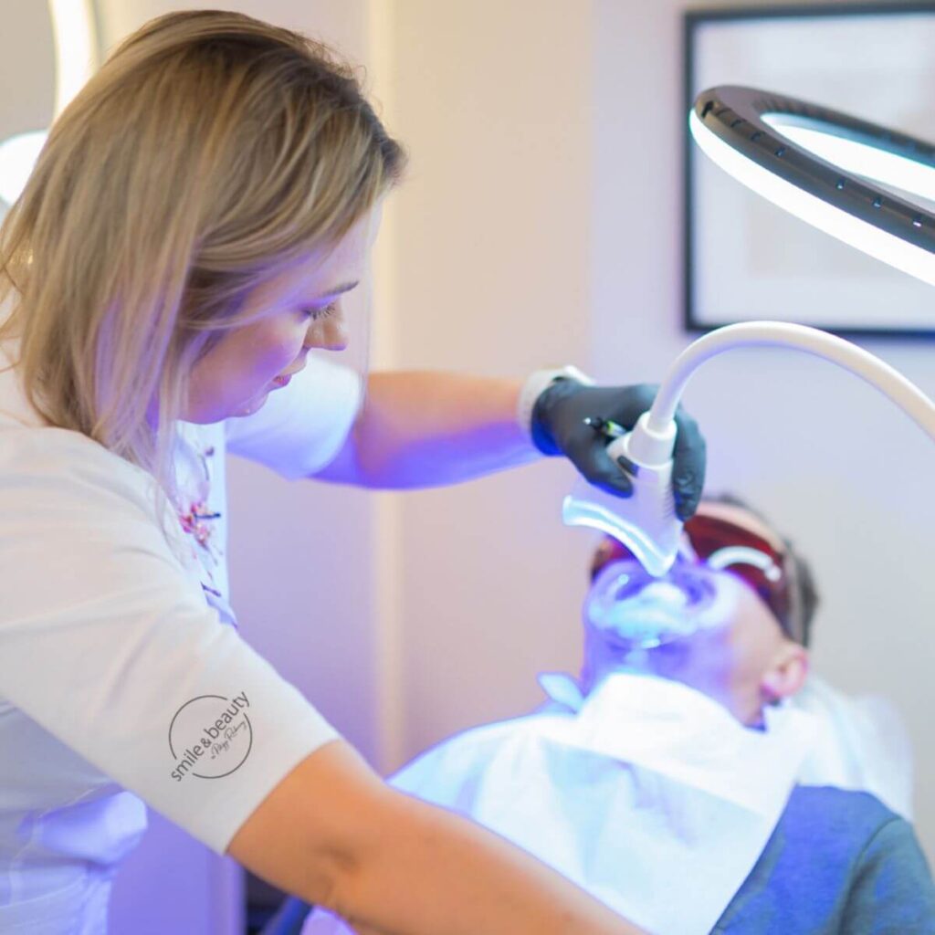 4_kosmetyczne_wybielane_zebow_ustron_wisla_istebna