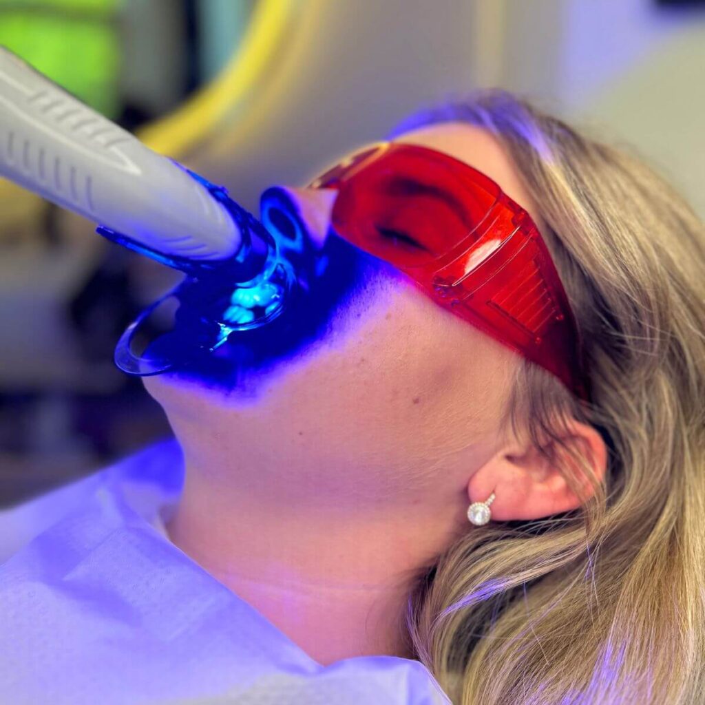 6_kosmetyczne_wybielane_zebow_ustron_cisownica_goleszow